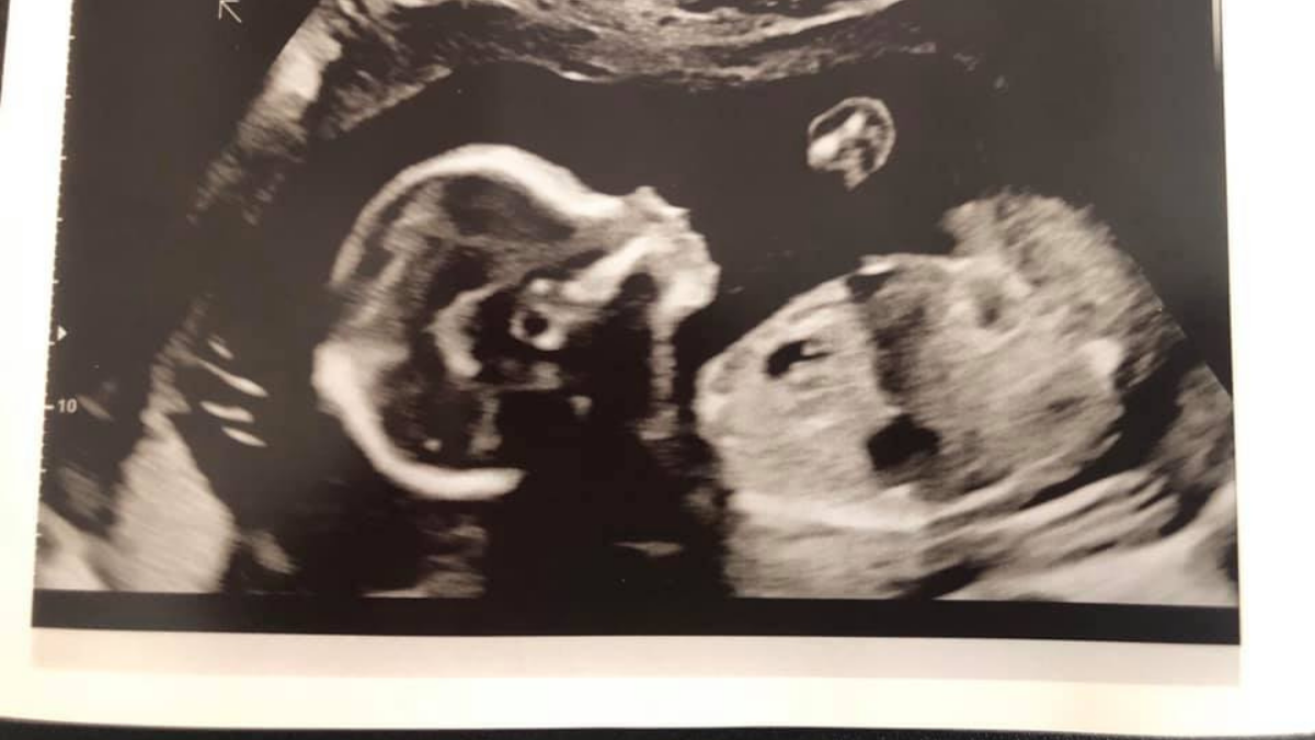 Pregnancy Stories | Rowena Winkler 